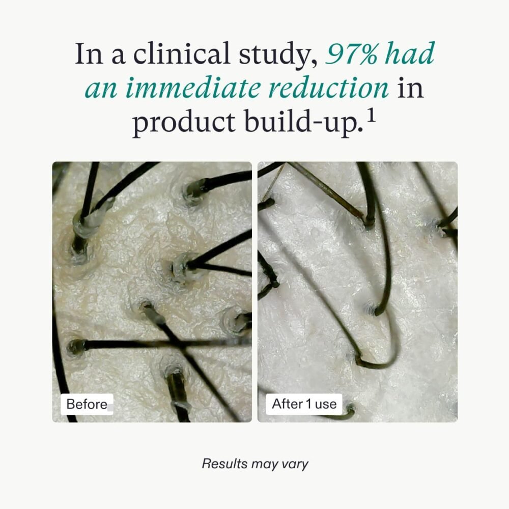 قناع تقشير فروة الرأس من Nutrafol - يقضي على تراكم المنتجات والزيوت لفروة رأس وشعر أكثر صحة، مُصمم خصيصًا للشعر الرقيق، آمن للاستخدام مع الصبغات والإضافات، 4 أونصات سائلة - الصورة 4