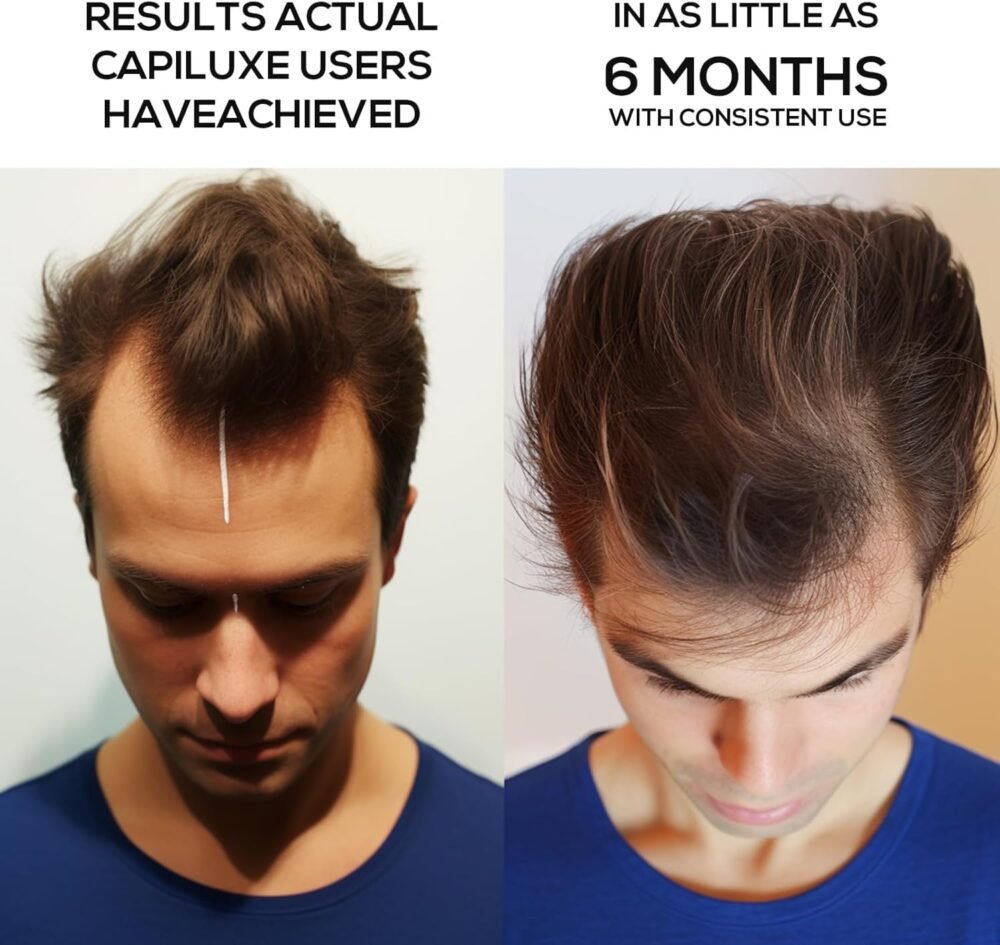 قبعة العلاج بالليزر لنمو الشعر - جهاز العلاج بالليزر لتساقط الشعر للرجال والنساء، علاج ضوء الأشعة الحمراء لنمو الشعر - الصورة 2