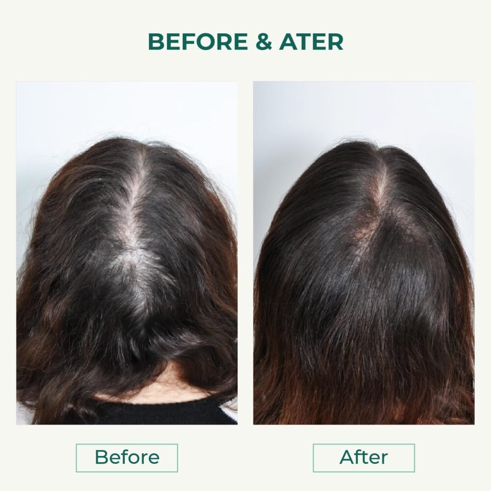 شامبو Thik&Fix لتكثيف الشعر ونموه للنساء - يعيد دورة النمو ويعالج تساقط الشعر بفعالية - 15.2 أونصة - الصورة 5