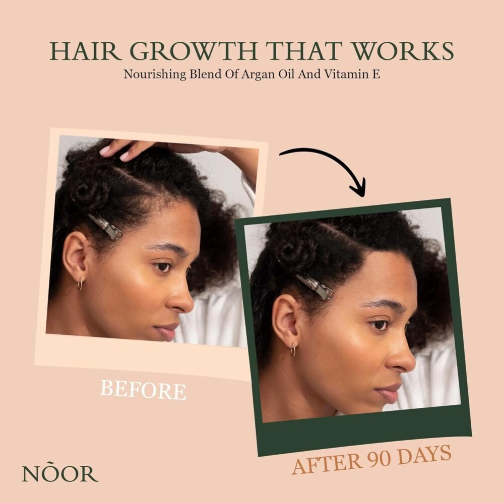 سيروم نمو الشعر NOOR HAIR من الزيتون الأفريقي - علاج لتساقط الشعر، للشعر المجعد والتالف، للحصول على شعر أكثر كثافة وصحة - مع فيتامينات طبيعية وزيت الأرغان - الصورة 3
