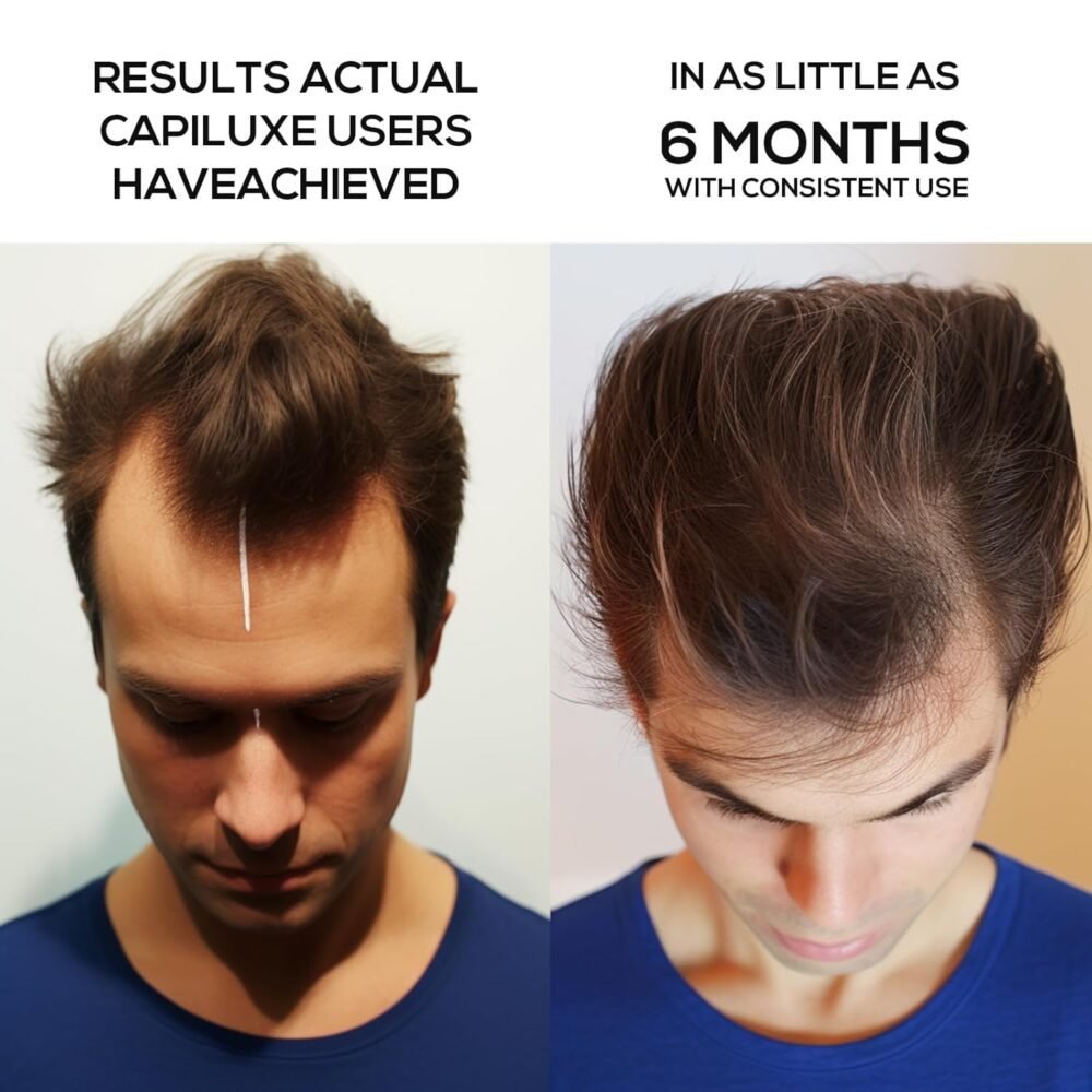 غطاء نمو الشعر بالليزر، قبعة العلاج بالليزر لإعادة نمو الشعر، جهاز علاج الشعر بالليزر، نظام نمو الشعر باستخدام العلاج بالضوء الأحمر لعلاج تساقط الشعر للرجال والنساء - الصورة 6