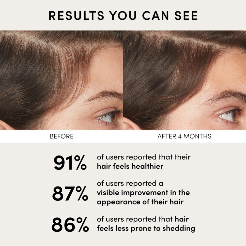 سيروم OUAI للعناية بفروة الرأس - سيروم موازن ومرطب مع مستخلص البرسيم الأحمر، الجنسنغ السيبيري والببتيدات لشعر أكثر كثافة وامتلاء - خالي من البارابين والفثالات والكبريتات للعناية بفروة الرأس (2 أونصة سائلة) - الصورة 5