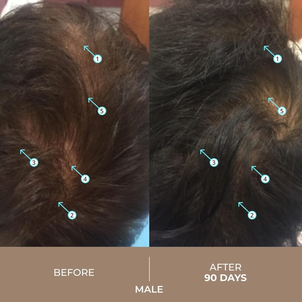 سيروم DS Laboratories Spectral.DNC-N لكثافة الشعر - 6 أونصات سائلة | للرجال والنساء مع 5% نانوكسيديل، كافيين، حمض أزلايكي، ريتينول لنمو الشعر، التكثيف ودعم صحة الفروة - الصورة 4