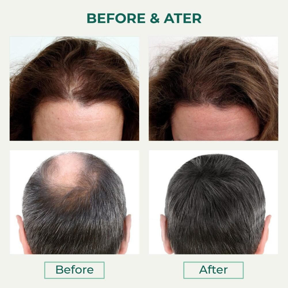 بلسم Thik&Fix لتكثيف الشعر وزيادة نموه - يعيد دورة نمو الشعر، علاج فعال لتساقط الشعر عند النساء - 15.2 أوقية - الصورة 5