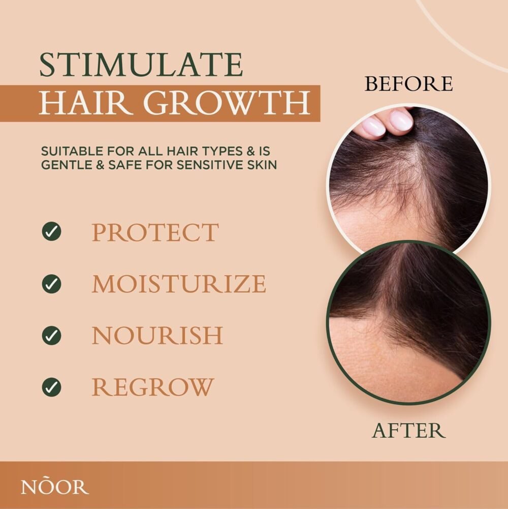 سيروم NOOR HAIR الفائق لنمو الشعر - علاج للشعر المجعد والتالف - الصورة 4