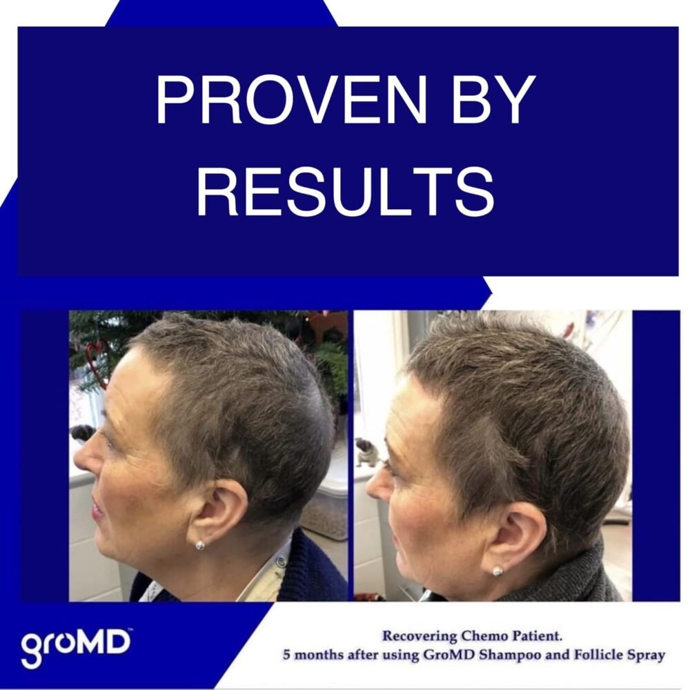 شامبو وبلسم البيوتين - شامبو نمو الشعر ومكافحة تساقط الشعر للرجال والنساء، علاج تجديد الشعر وزيادة الكثافة، يحتوي على زيت الأركان ومكونات مانعة للـ DHT، صيغة طبية، 10 أونصة - الصورة 2