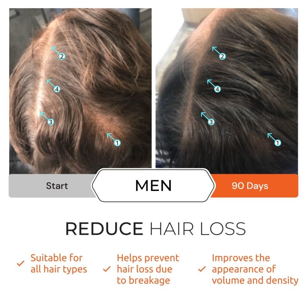 شامبو د.إس لابوراتوريز ريفيتا - شامبو نمو الشعر مع مانع DHT وتركيبة البيوتين لزيادة كثافة الشعر وعلاجه للرجال والنساء - الصورة 5