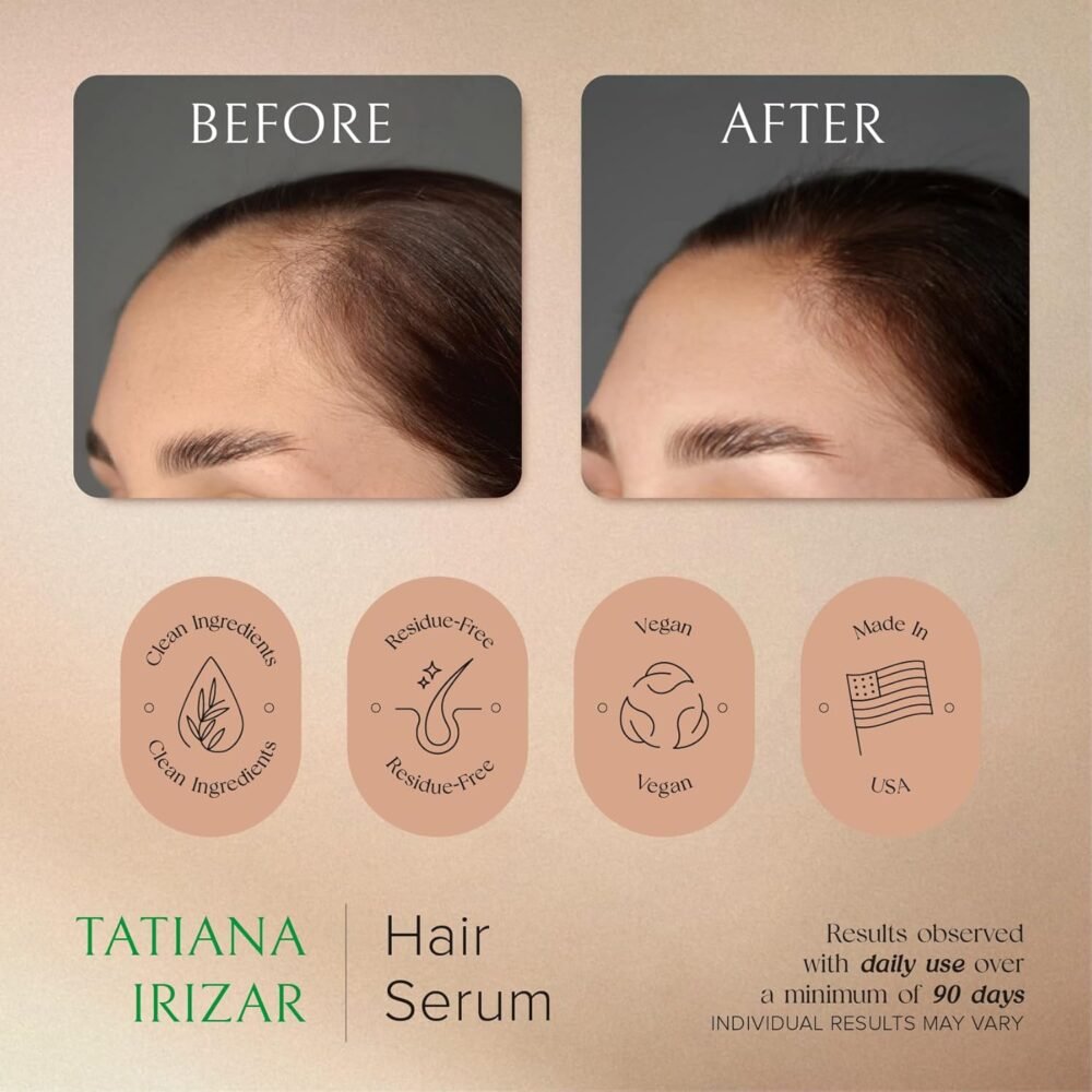 سيروم نمو الشعر للنساء - 3 عبوات من سيروم فروة الرأس لنمو الشعر - غير دهني، يحتوي على إكليل الجبل والأملة - للعناية بالشعر، نباتي - 1 أونصة سائلة لكل عبوة، علاج لتساقط الشعر ونمو الشعر للنساء - الصورة 4