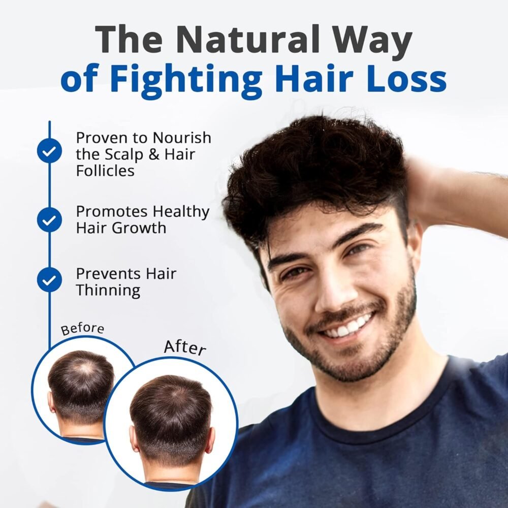 سيروم لتساقط الشعر ونموه مع زيت السا بالمطو، زيت القراص، زيت إكليل الجبل، برائحة النعناع، للرجال والنساء - 4 أونصة سائلة - الصورة 3