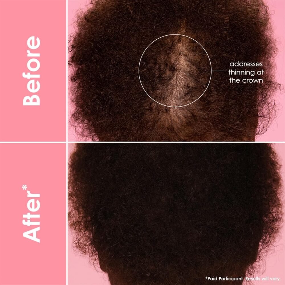 GrandeHAIR Enhancing Serum - سيروم تعزيز نمو الشعر - الصورة 6