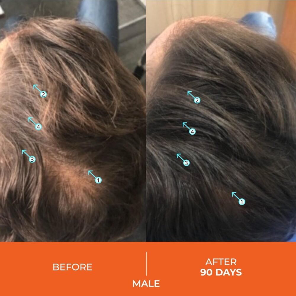 مجموعة شامبو وبلسم Revita من DS Laboratories - شامبو وبلسم لنمو الشعر، شامبو وبلسم لتكثيف الشعر للنساء والرجال، مع علاج منع DHT لمكافحة تساقط الشعر - الصورة 3