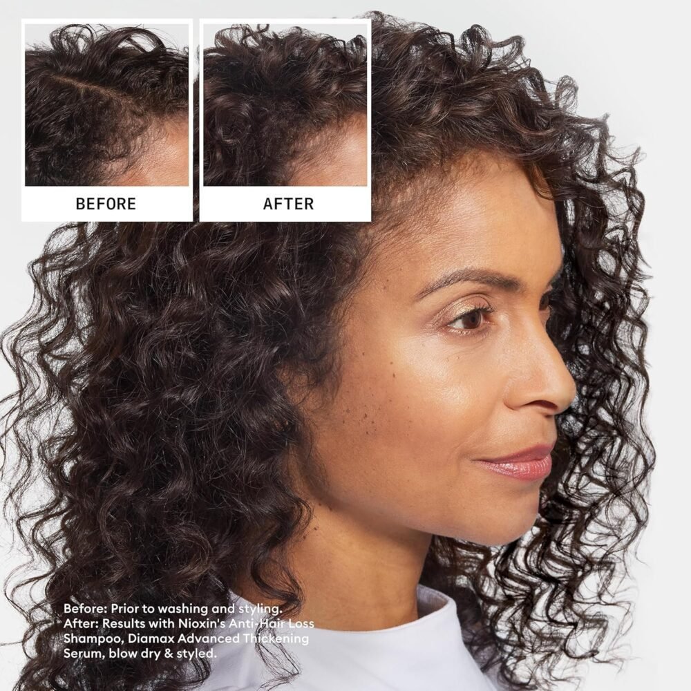 Nioxin Hair Fall Defense Shampoo - شامبو ضد تساقط الشعر - الصورة 4