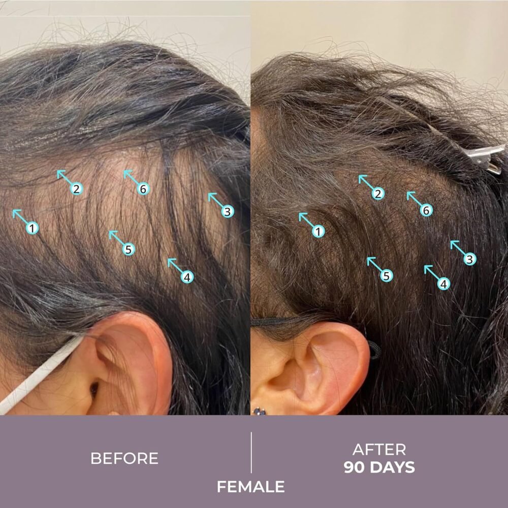 سيروم DS Laboratories Spectral.CSF Biotin لتكثيف الشعر ونموه - علاج لتساقط الشعر وزيادة الكثافة للنساء - الصورة 4