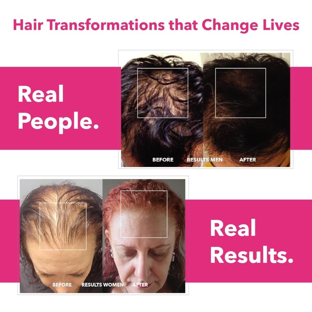 ⁦Ayurvedic Growth Accelerator Hair Serum - سيروم تسريع نمو الشعر الأيورفيدي، يقلل من التساقط، يعزز الكثافة، ويمتص بسهولة في فروة الرأس - سيروم غير دهني لنمو الشعر وتجديده للنساء (100 مل)⁩ - الصورة ⁦5⁩