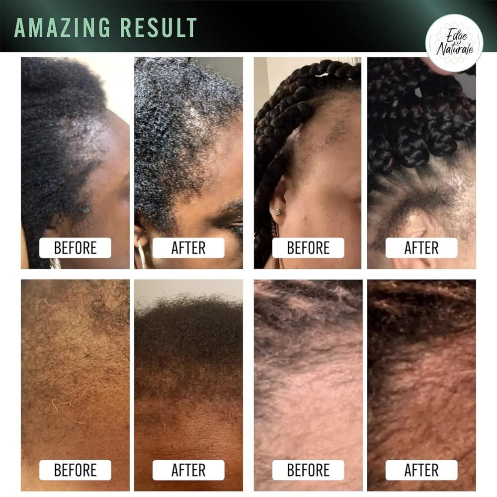 Edge Naturale - مكمل تعزيز نمو الشعر للأطراف - يعالج وينمّي حواف الشعر لجميع أنواع الشعر (4 أوقية) - صنع في الولايات المتحدة - الصورة 3