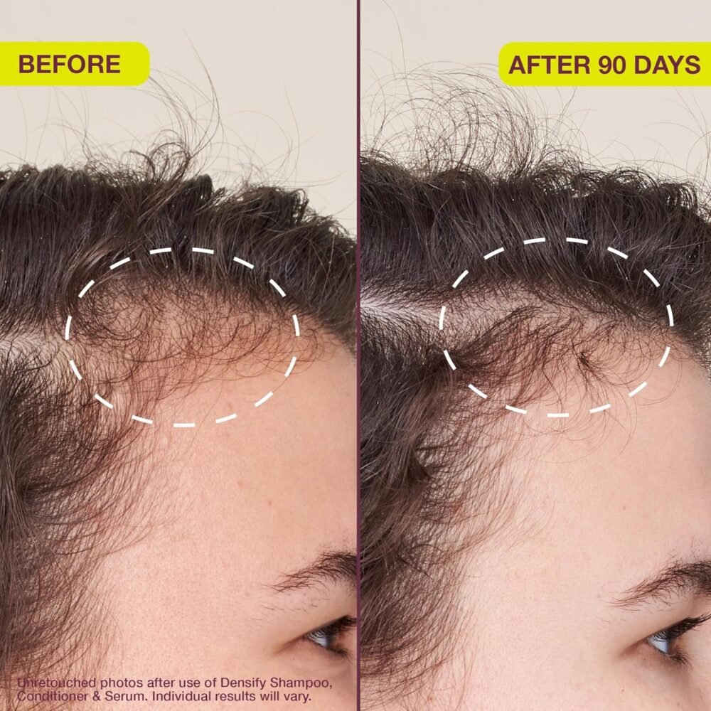 سيروم لتكثيف الشعر وتقويته للشعر الرقيق - 1 أونصة - الصورة 3