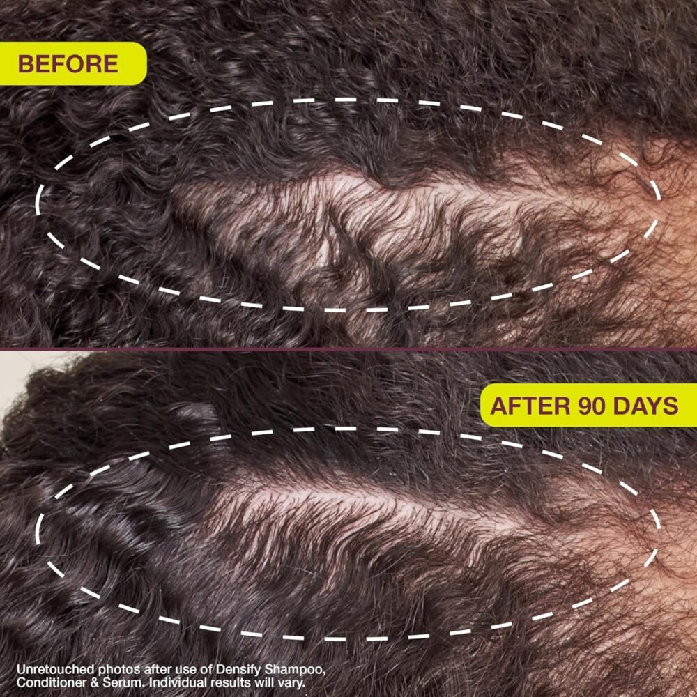 سيروم لتكثيف الشعر وتقويته للشعر الرقيق - 1 أونصة - الصورة 4