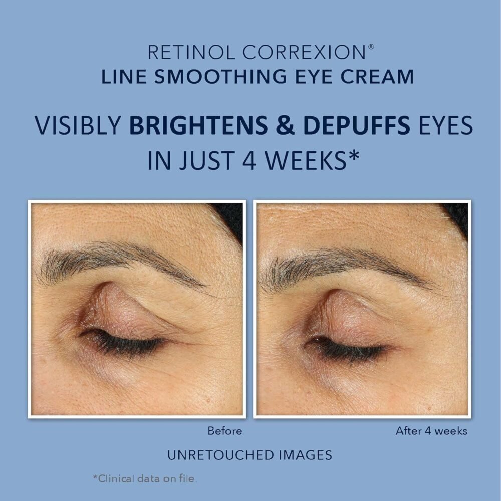 مجموعة روك ريتينول كوركشن للقضاء على التجاعيد | كريم الليل لمحاربة الشيخوخة + كريم يومي للهالات السوداء واحتباس السوائل تحت العين | مجموعة عناية بالبشرة | هدايا عيد الميلاد (قد يختلف التغليف) - الصورة 3