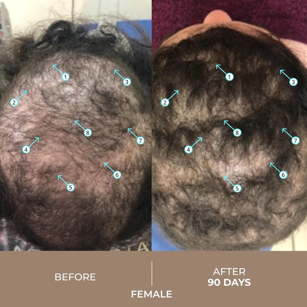 سيروم DS Laboratories Spectral.DNC-N لكثافة الشعر - 6 أونصات سائلة | للرجال والنساء مع 5% نانوكسيديل، كافيين، حمض أزلايكي، ريتينول لنمو الشعر، التكثيف ودعم صحة الفروة - الصورة 3