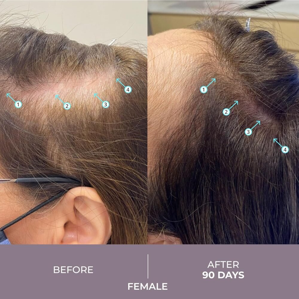 سيروم DS Laboratories Spectral.CSF Biotin لتكثيف الشعر ونموه - علاج لتساقط الشعر وزيادة الكثافة للنساء - الصورة 3